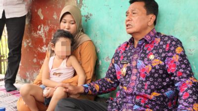 Bupati Tangerang kunjungi SM, anak 4 tahun penderita retinoblastoma, untuk dukungan pengobatan dan fasilitas MCK.